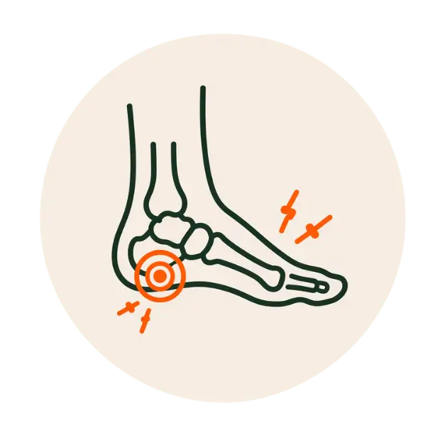 Foot pain and instability - Rolf Method predating Rolfing Boston